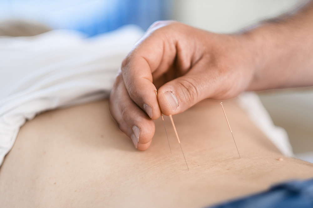 sportmediziner-und-orthopaede-koeln-holweide-l-akupunktur-dscf5098 sportmediziner-und-orthopaede-koeln-holweide- l-akupunktur-dscf5098